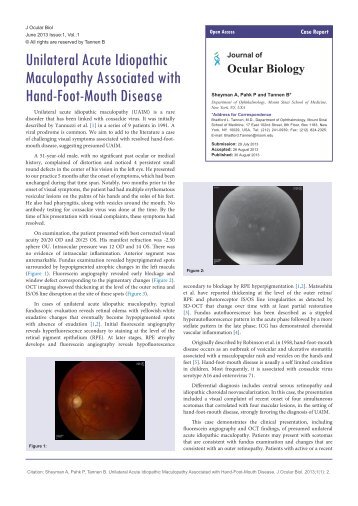 eosinophilic pneumonia vicodin eosinophilic pneumonia vicodin