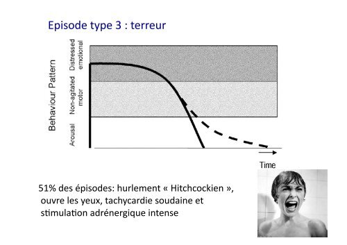 Parasomnies de sommeil lent profond - SPLF