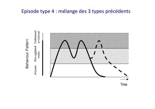 Parasomnies de sommeil lent profond - SPLF