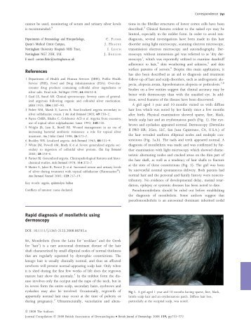 References Rapid diagnosis of monilethrix using dermoscopy