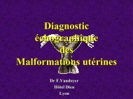 Diagnostic échographique des Malformations utérines