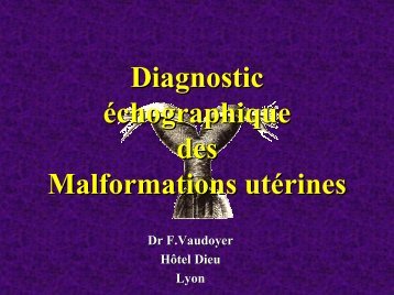 Diagnostic échographique des Malformations utérines