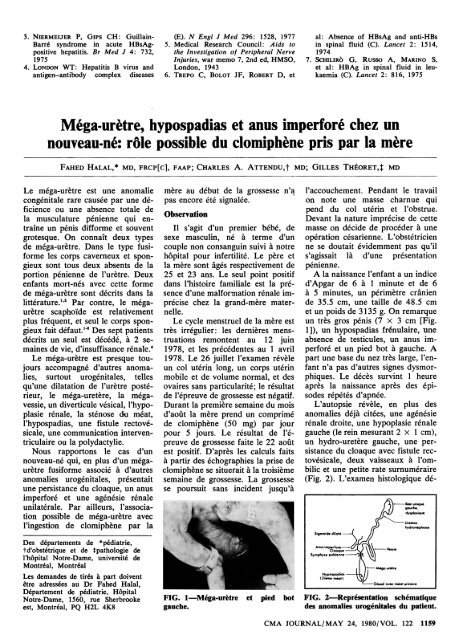 Mega Uretre Hypospadias Et Anus Imperfore Chez Un Mega Uretre Hypospadias Et Anus Imperfore Chez Un