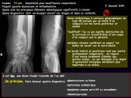 LM CC ostéo-artic métastases osseuses cancer du rein