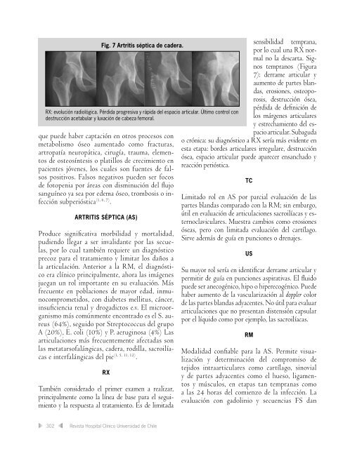 Evaluación por Imágenes de Infecciones en el Sistema ...