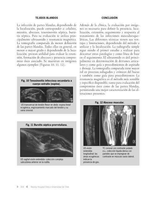 Evaluación por Imágenes de Infecciones en el Sistema ...