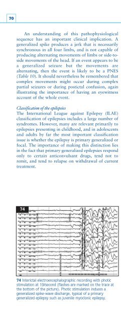 Understanding Neurology