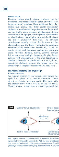 Understanding Neurology