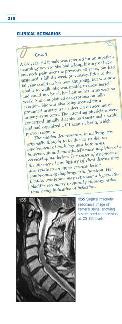 Understanding Neurology