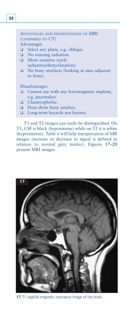 Understanding Neurology