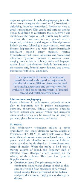 Understanding Neurology