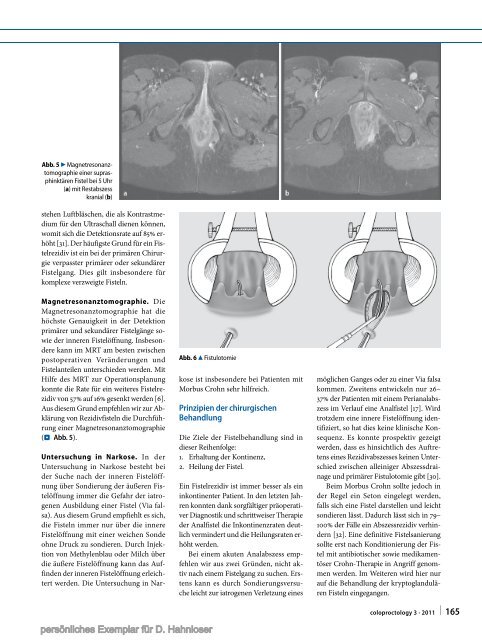 Behandlungsstandards für Pilonidalsinus und ... - Notes Chirurgie