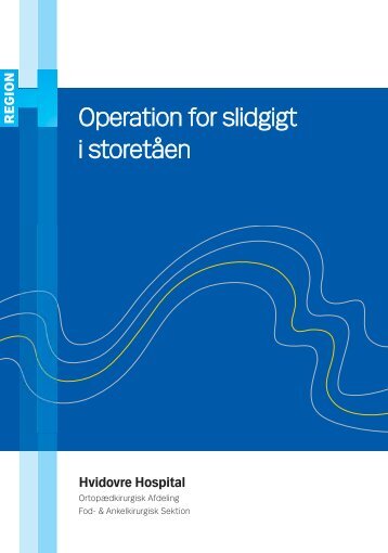 Operation for slidgigt i storetåen