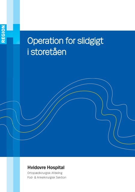 Operation for slidgigt i storetåen