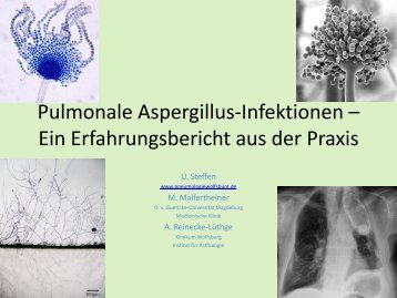 Pulmonale Aspergillus-Infektionen – Ein Erfahrungsbericht aus der ...