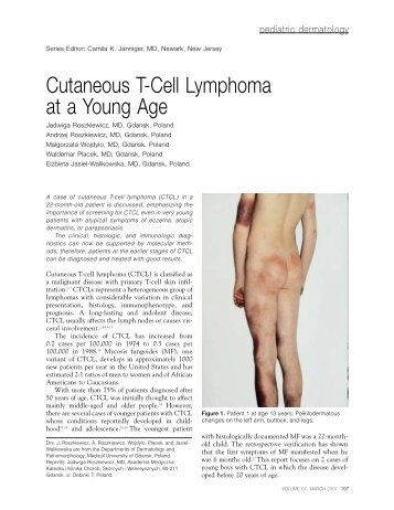 Cutaneous T-Cell Lymphoma at a Young Age - Cardiology News