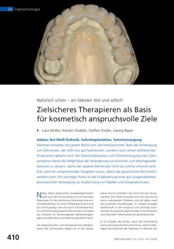 Artikel herunterladen (PDF) - Zahnärztin Dr. Lara Müller - Praxis am ...