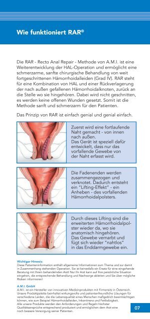 Hämorrhoiden - Chirurgische Gemeinschaftspraxis Germering