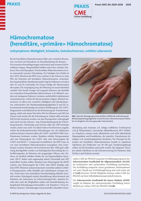 Hämochromatose (hereditäre, «primäre» Hämochromatose)