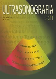 skan datowania przez przezroczystość nuchal