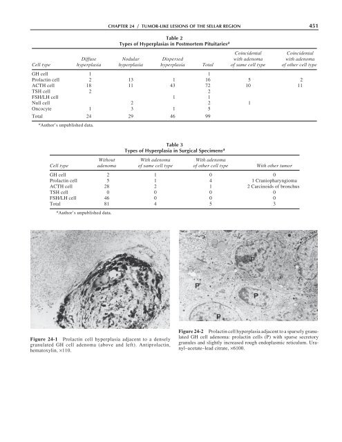 Diagnosis and Management of Pituitary Tumors