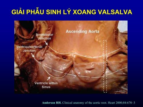 gi¶i phÉu sinh lý xoang valsalva