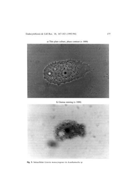 FREE-LIVING AMOEBA: INTERACTIONS WITH ENVIRONMENTAL ...