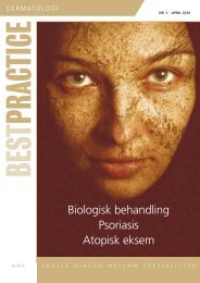Biologisk behandling Psoriasis Atopisk eksem - BESTPRACTICE.NO