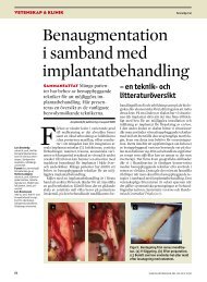 Benaugmentation i samband med implantatbehandling