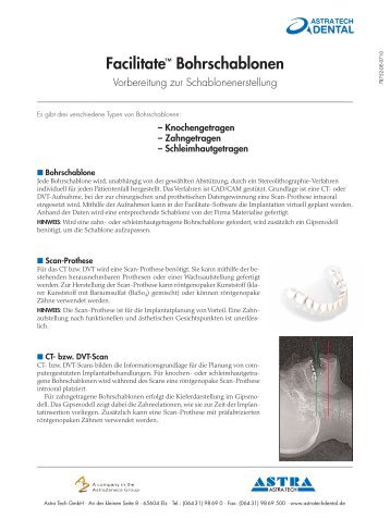 Facilitate™ Bohrschablonen - Astra Tech