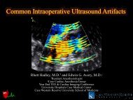 Common Intraoperative Ultrasound Artifacts - Casecag.com