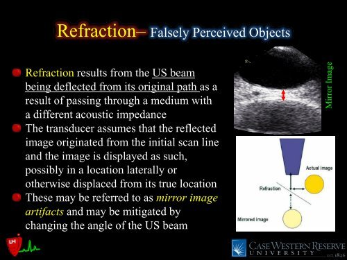 Common Intraoperative Ultrasound Artifacts - Casecag.com