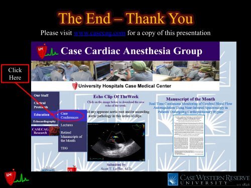 Common Intraoperative Ultrasound Artifacts - Casecag.com