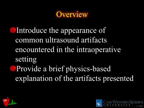 Common Intraoperative Ultrasound Artifacts - Casecag.com