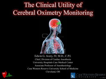 The Clinical Utility of Monitoring Cerebral Oximetry - Casecag.com