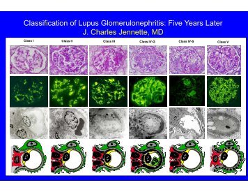 Classification of Lupus Glomerulonephritis: Five Years Later