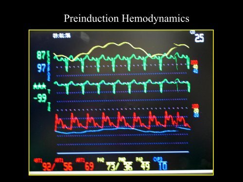 LVOT Obstruction: Patients at Risk - Casecag.com