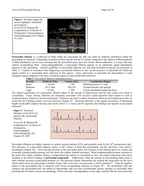 Echocardiographic Evaluation of Pericardial Disease - Casecag.com