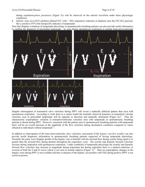 Echocardiographic Evaluation of Pericardial Disease - Casecag.com