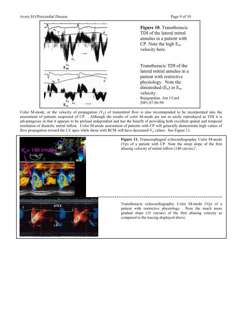 Echocardiographic Evaluation of Pericardial Disease - Casecag.com