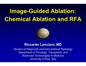 Image-Guided Ablation: Chemical Ablation and RFA - SIR Foundation