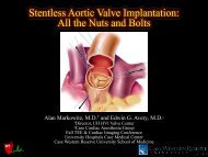 Stentless Aortic Valve Implantation: All the Nuts and ... - Casecag.com