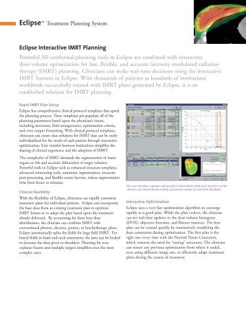 Eclipse Interactive IMRT Planning - Behestan Darman
