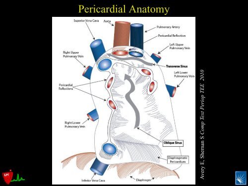 Pericardial Pathology - Casecag.com