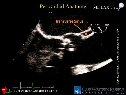 Pericardial Pathology - Casecag.com