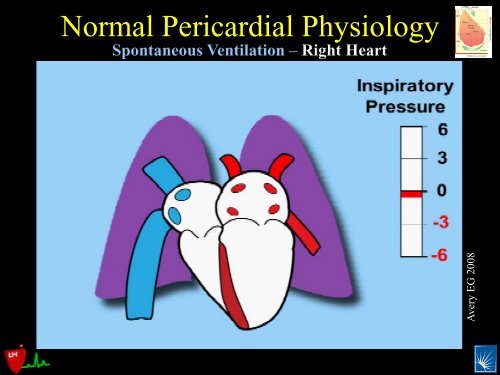 Pericardial Pathology - Casecag.com