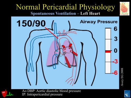 Pericardial Pathology - Casecag.com