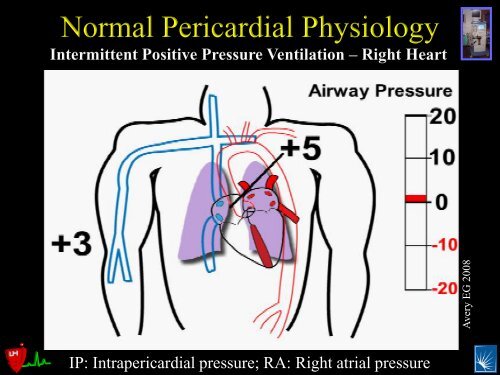 Pericardial Pathology - Casecag.com
