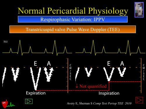 Pericardial Pathology - Casecag.com