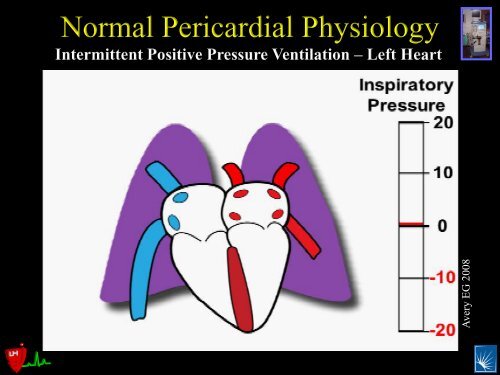 Pericardial Pathology - Casecag.com